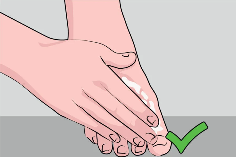 Diabetic foot care at home: Guidelines for Treatment