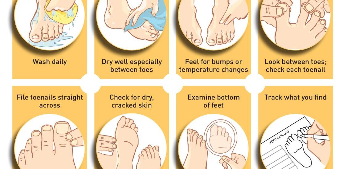 Diabetic foot care at home diabetic-foot-care-at-home-guidelines-for-treatment
