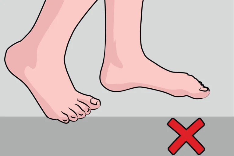 Diabetic foot care at home: Guidelines for Treatment