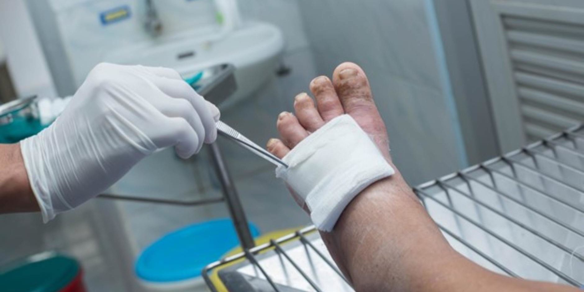 How long does a diabetic foot ulcer take to heal 
