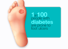 How Long Does a Diabetic Foot Ulcer Take To Heal?