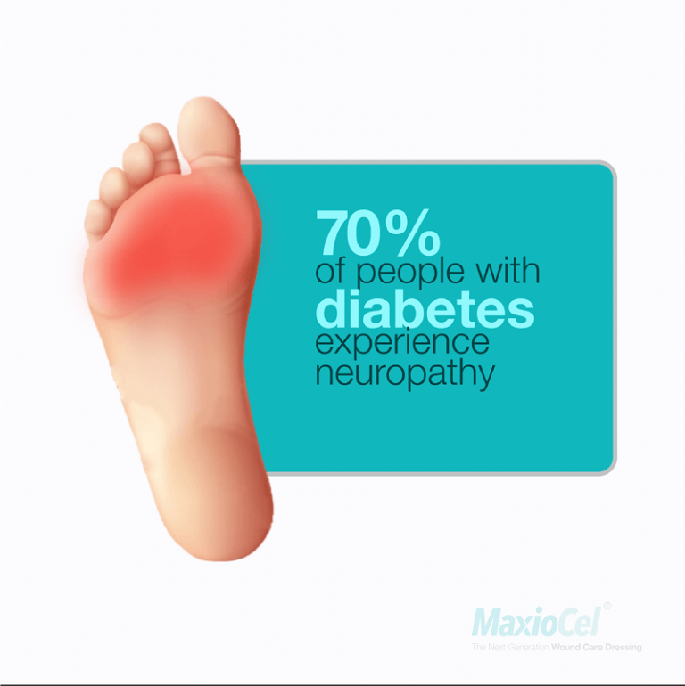 Diabetic Foot Ulcers: Risk Factors, Symptoms & Treatment