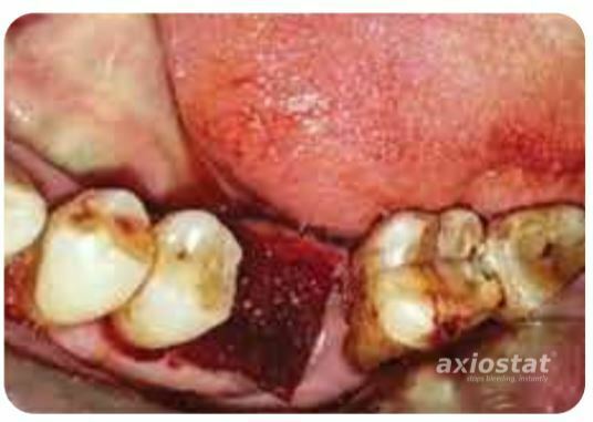 DENTAL