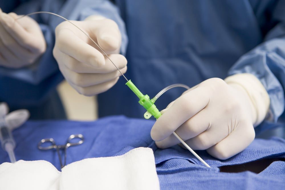 Cardiac-Catheterization-Percutaneous-Coronary-Intervention.jpg.optimal
