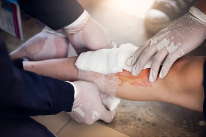 Stop Bleeding Fast