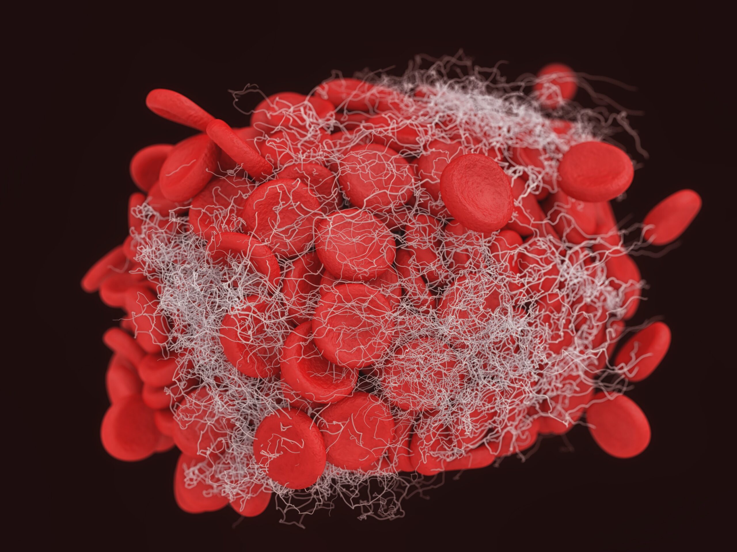 Antibiotic-Resistance Antibiotic Resistance:
