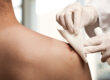 Hemostatic Dressing