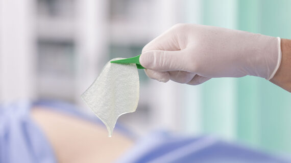 Pressure Ulcers