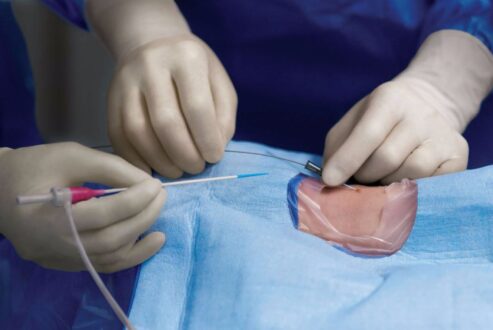 Wound Healing Myths